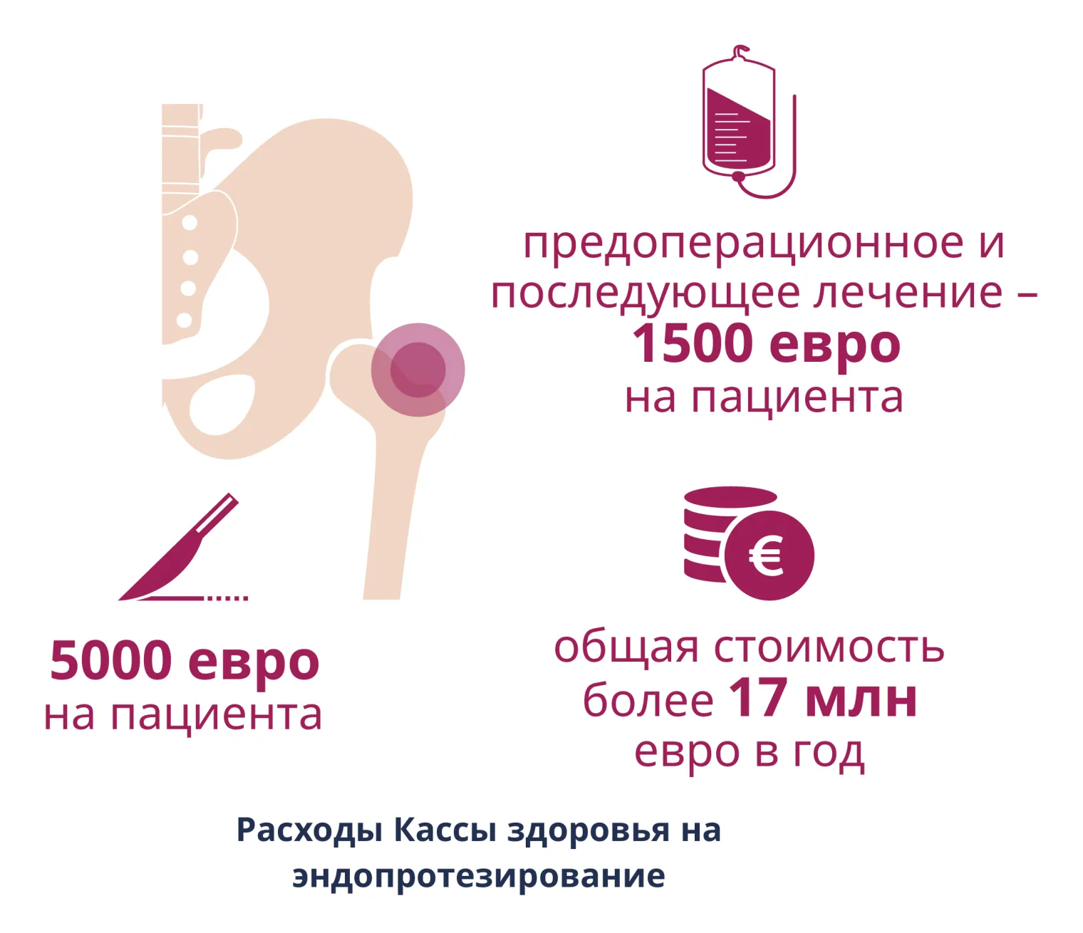 Эндопротезирование