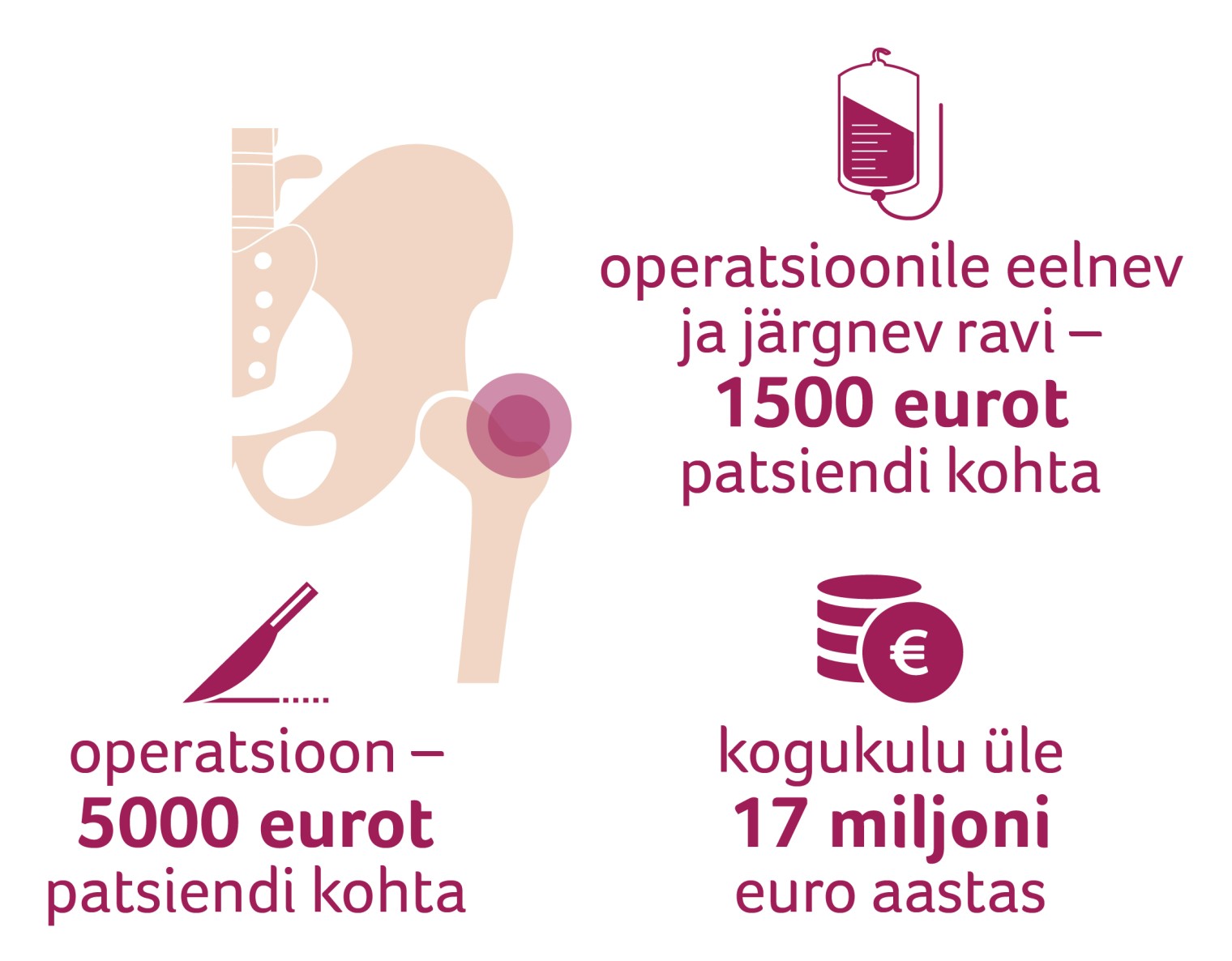 arvutiga joonistatud vaagna luu ja statistika